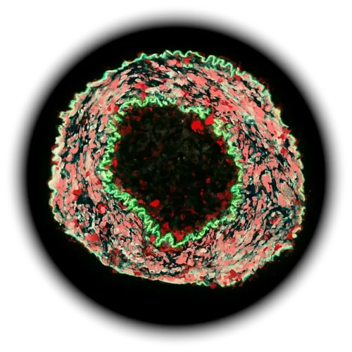 Abstract circular microscopic image with layered red and green textures surrounding a dark center.